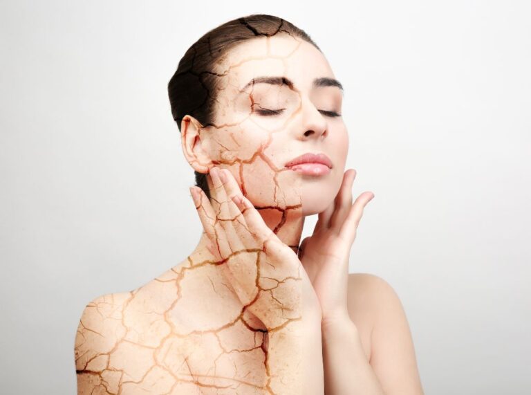 Nuevo tratamiento para combatir la piel sensible