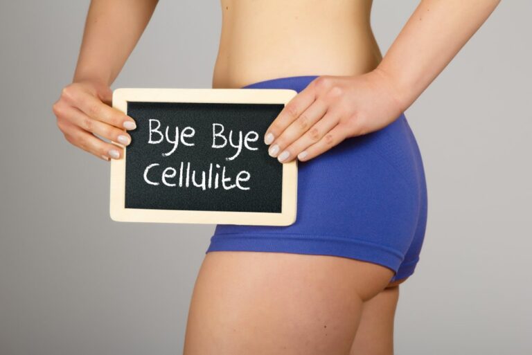 ¿Cómo eliminar la celulitis? Consejos y ejercicios para reducirla.